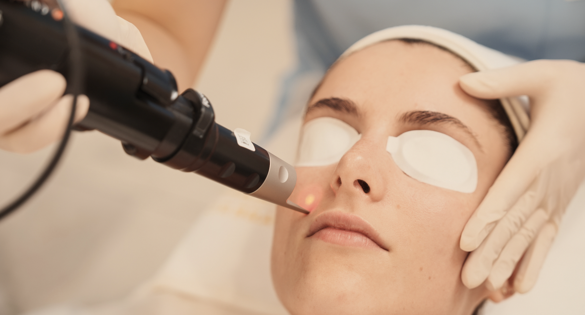 Laser Pigmentation Removal ×1